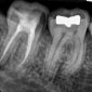 Diş Röntgen Sonucu Görüntüle